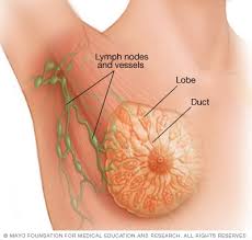 Changes in treatment are made as the cancer grows or spreads to new places in your body. Breast Cancer Symptoms And Causes Mayo Clinic