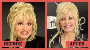Dolly parton definitely is a courageous woman to undergo so many surgical … Dolly Parton Plastic Surgery She Never Denies It Plastic Surgery Dolly Parton Plastic Surgery Bad Plastic Surgeries