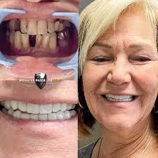 Ron Dorst's Instagram, Twitter & Facebook