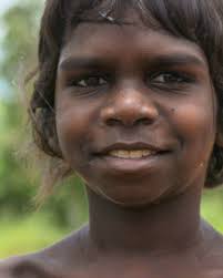 We met 'little Jeremy' in Wadeye, in Australia's Northern Territory,  shortly after his open heart surgery for Rheumatic Heart Disease (RHD). The  physical toll the surgery had taken