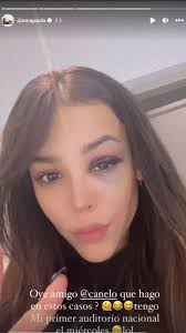 Danna Paola: las impactantes imágenes de su ceja rota en México