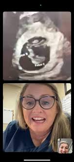 Many Mini Mostellers