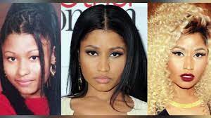 We can also compare her photos prior to 2013 and those clicked in the year 2014. Nicki Minaj Before And After Transformation Plastic Surgery Makeup And More Video Dailymotion