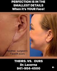 Tummy Tuck and Facial Rejuvenation Transform a Life-Changing Weight Loss  Journey