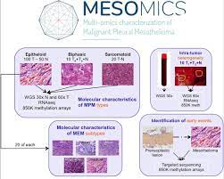 Mesothelioma is an aggressive cancer that affects the lungs, heart, abdomen or testiciles. Highlights Of The 14th International Mesothelioma Interest Group Meeting Pathologic Separation Of Benign From Malignant Mesothelial Proliferations And Histologic Molecular Analysis Of Malignant Mesothelioma Subtypes Sciencedirect