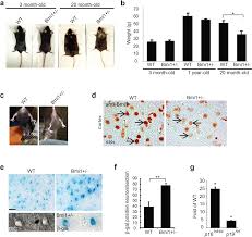 Heterochromatic Genome Instability And Neurodegeneration