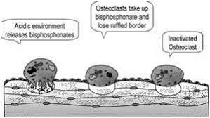 Image result for Bisphosphonates