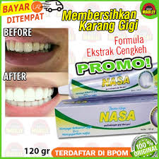 Jual Pasta Gigi Nasa Hebal Lazada Co Id