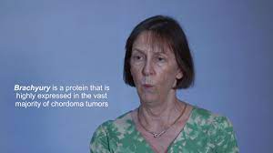 Check spelling or type a new query. Chordoma Cancer Causes Symptoms Life Expectancy Treatment