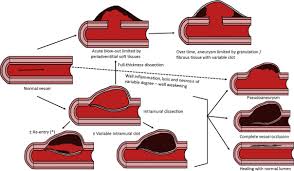 Image result for Pseudoeriosema