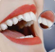 Dental Emergencies Your Clairemont Dentist Is Ready To Help You Dental Emergency Emergency Dental Care Teeth Dentist