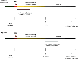 We did not find results for: Electrical Stimulation Of The Ventral Hippocampal Commissure Delays Experimental Epilepsy And Is Associated With Altered Microrna Expression Brain Stimulation Basic Translational And Clinical Research In Neuromodulation