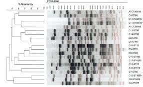 Households of all kinds lived within the long line of huge buildings around here. Detection Of Multiple Hypervirulent Klebsiella Pneumoniae Strains In A New York City Hospital Through Screening Of Virulence Genes Clinical Microbiology And Infection