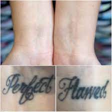 Maybe you would like to learn more about one of these? Home Evolve Tattoo Removal