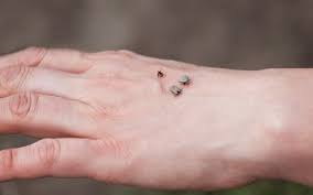 Image result for flea bites