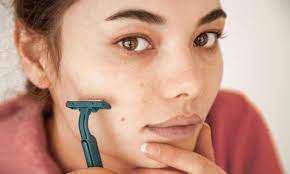 Sorry if the pic is too close for comfort but help i have peach fuzz around my lips i've never had facial hair problems before can any one. Female Shaving Why Women Are Removing Their Facial Hair From Chin Growth To Peach Fuzz Beauty The Guardian