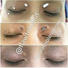 Okay Kakak2 Yang Ada Pundi Minyak Berlebihan Dimuka Di Kelopak Mata Yang Utamanya Boleh La Guna Krim Kami Untuk Buang Instagram Instagram Posts Instagram Users