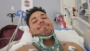 Halloween performer faces biggest nightmare after car accident