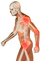 Food and your bones — osteoporosis nutrition guidelines. Osteoporosis Miami Obgyn