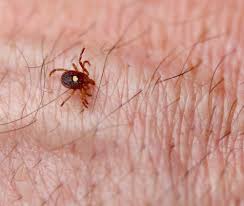 Jun 08, 2021 · there was one confirmed case of lyme disease reported between jan. How A Tick Bite Can Make You Allergic To Red Meat Florida E N T Allergy