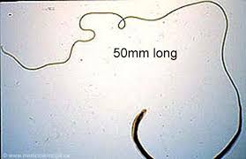 Image result for Whipworm