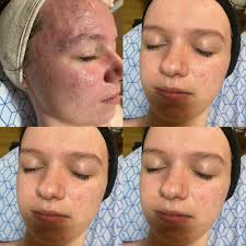 THE BEST 10 NAIL SALONS in RENFREW, ON