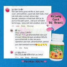 Kita bisa mengetahui bahwa darah yang keluar bukanlah darah haid dari adanya. 36 Testimoni Best Ideas Cysts Fibroid Cyst Simple