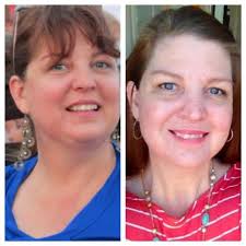 Before or after anesthesia induction or shortly postop >12 yo or >40 kg Thyroid Recovery