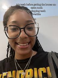 My Transformative Braces Journey: A 2023 Milestone