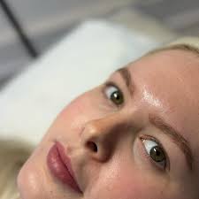 Angel Face Laser & Aesthetics