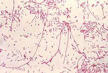Die legionärskrankheit (legionellose) verursacht zunächst allgemeine symptome wie unwohlsein, gliederschmerzen, kopfschmerzen und reizhusten. Legionella Pneumophila Wikipedia