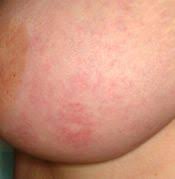 The pictures below will help you to determine if there is a problem which you need to address with you doctor. Yvonne Pearl Ypearl1 Profile Pinterest