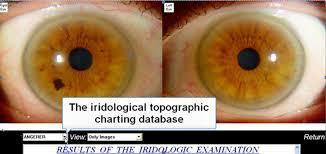 iridology charts iridology analysis professional