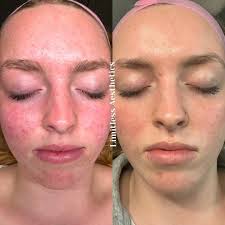 Limitless Aesthetics