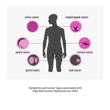 Image result for human papillomavirus symptoms