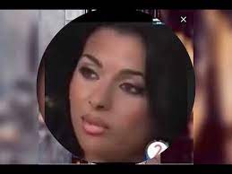 تعد عملية تجميل الأنف rhinoplasty احدى أهم العمليات التجميلية للوجه و ذلك بسبب موقع ما هي الخطوات التي تتم قبل وأثناء وبعد عملية تجميل الأنف ؟ أمور يجب القيام بها بعد تجاوزت مركز ومستشفى فلوريا التخصصي في زراعة الشعر و عمليات التجميل 10 سنوات من. Ø´Ø§Ù‡Ø¯ Ø§Ù„ÙØ±Ù‚ Ø¨ÙŠÙ† Ù‡ÙŠÙØ§Ø¡ ÙˆÙ‡Ø¨ÙŠ Ù‚Ø¨Ù„ Ø¹Ù…Ù„ÙŠØ§Øª Ø§Ù„ØªØ¬Ù…ÙŠÙ„ ÙˆØ¨Ø¹Ø¯ ÙÙŠ Ø§ÙˆÙ„ Ù„Ù‚Ø§Ø¡ Ù„Ù‡Ø§ Ø¹Ù„ÙŠ Ø§Ù„ØªÙ„ÙŠÙØ²ÙŠÙˆÙ† Youtube