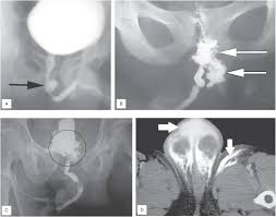 Image result for Genitourinary Trauma