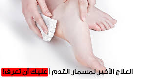 مسمار القدم كل ما تحتاج معرفته عن طرق العلاج ويب طب