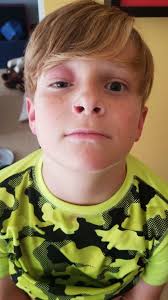 The two little preemies twins Henry and his brother had a pretty rough  being born so early! Please pray for little Henry as he got an infection he  has a colostomy bag