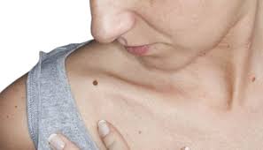 Evdeki Malzemelerle Cilt Bakimi Ve Saglik Panosundaki Pin