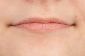 Washing your face strictly with warm water until the cold sores disappear. Sunburned Lips Symptoms Treatment And Prevention Methods Parents