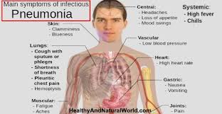 Pneumonia Is It Contagious Causes Symptoms And Transmission Pneumonia Symptoms Pneumonia Remedies Pneumonia Causes