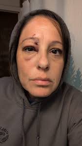 Deer Hunting and Doe Management in Michigan