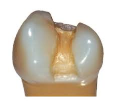 Linkbucks service discontinued after nearly 21 years of service, linkbucks has decided to suspend operations. C Factor C Value C ãƒ•ã‚¡ã‚¯ã‚¿ãƒ¼ Dental Note