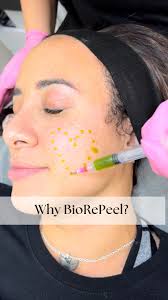 Why are we loving the BioRepeel? It treats all skin types and concerns! ,  Want to try it? Keep an eye out for our upcoming Valentines Day Specials🥳,  ⠀⠀⠀⠀⠀⠀⠀⠀⠀⠀⠀, ⠀⠀⠀⠀⠀⠀⠀⠀⠀⠀⠀, ⠀⠀⠀⠀⠀⠀⠀⠀⠀⠀⠀, ⠀⠀⠀⠀⠀⠀⠀⠀⠀⠀⠀, ...