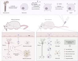 Image result for Modified Apt Test