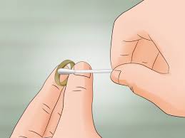 However, small percentage of people are indeed affected by allergy to gold itself. 3 Ways To Cure A Skin Rash Under A Ring Wikihow
