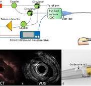 Ultrafast IVUS-OCT imaging system and catheter.: (a ...