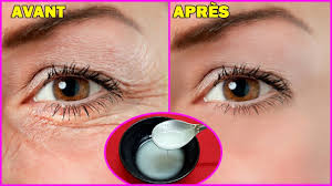 Appliquer Ce Melange Sur Votre Visage Pendant 7 Jours Elimine Les Taches Brunes Et Blanchit La Peau Youtube