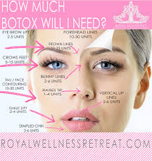 In a scientific study done particularly on this product, it was shown to work better at treating crow's feet than other. Botox Dysport Royal Aesthetics